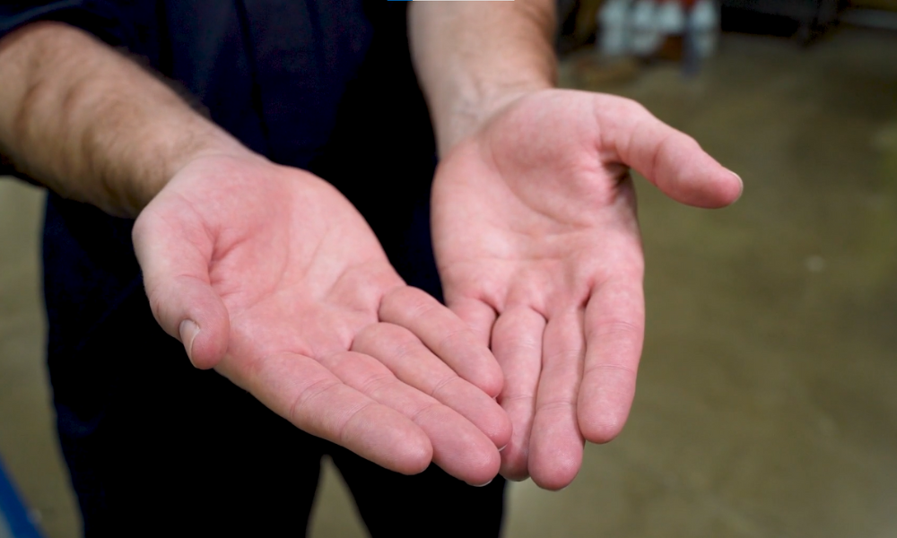 healthy hands