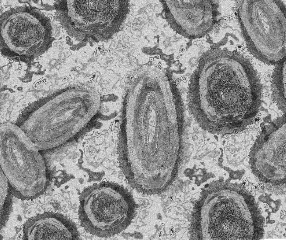 Monkeypox virus bacteria